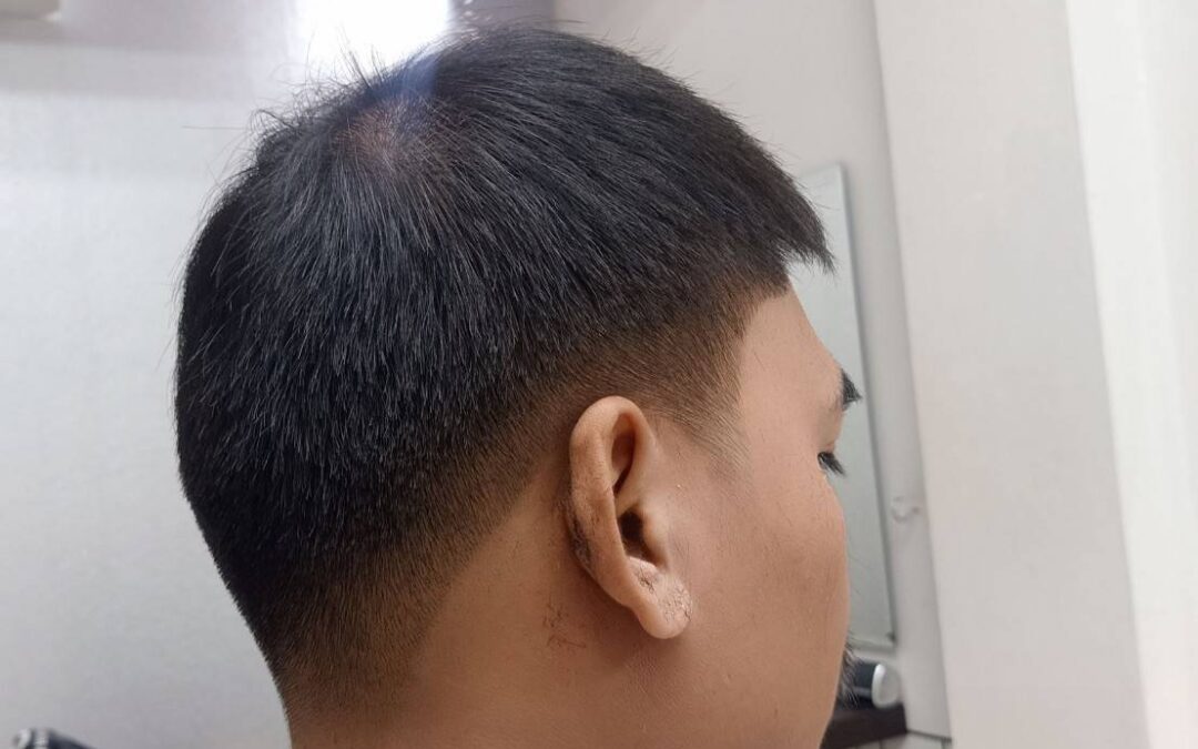 ใบหน้าอ้วนใหญ่