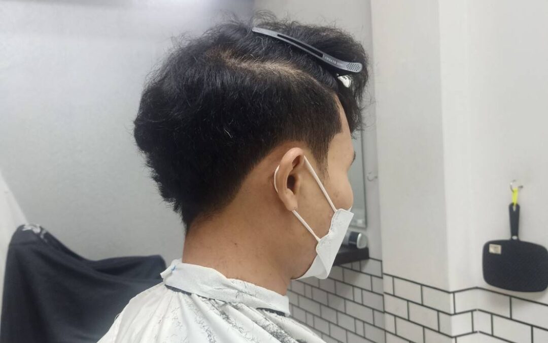 ใบหน้าอ้วนใหญ่